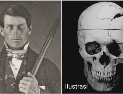 Kasus Phineas Gage: Sebuah Ledakan dan Besi Menjadi Pengantar dalam Kajian Neurosains