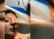 Dianiaya Pasangan, Dj Cantik di Pandanwangi Malang Dilarikan ke Rumah Sakit